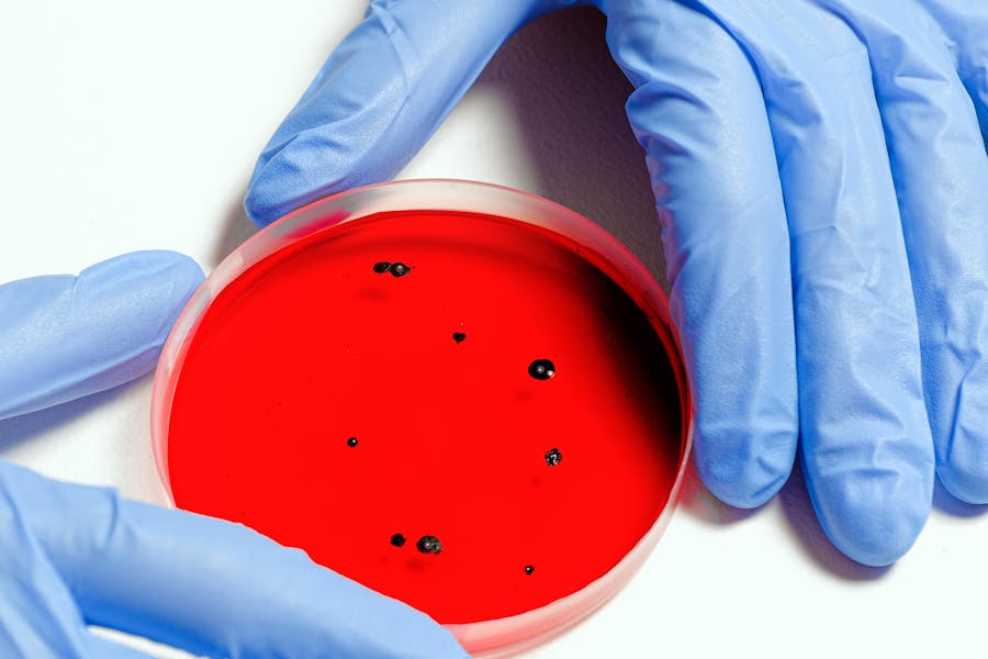 Co to jest HPV i jak można się nim zarazić?a się